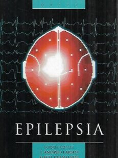 Epilepsia