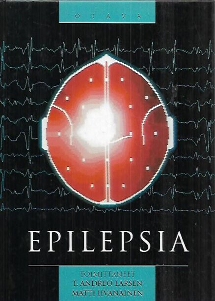 Epilepsia